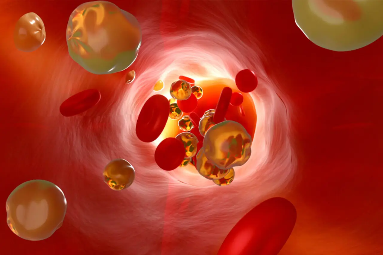 Allerta tumori del sangue: ecco i tre più comuni e i sintomi silenziosi che li caratterizzano